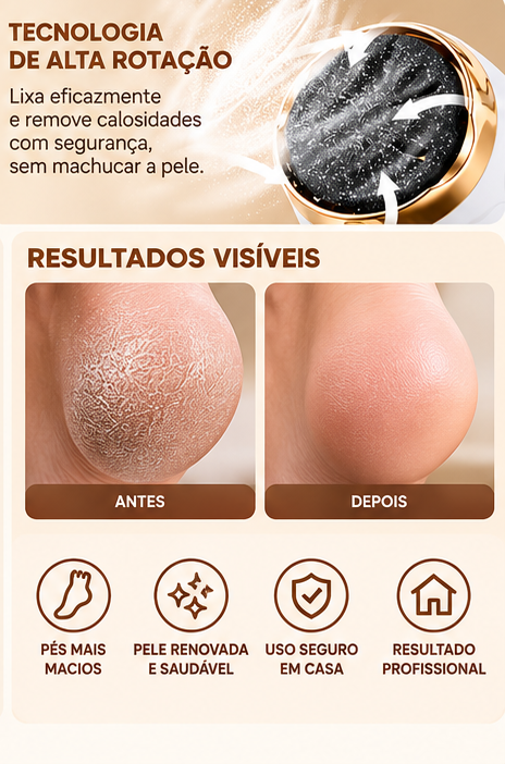 Lixa Elétrica para Pés Removedor de Calos e Rachaduras Pedicure Massageador Portátil