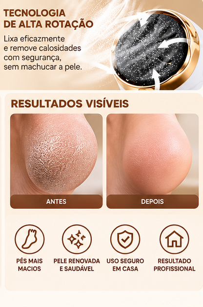 Lixa Elétrica para Pés Removedor de Calos e Rachaduras Pedicure Massageador Portátil